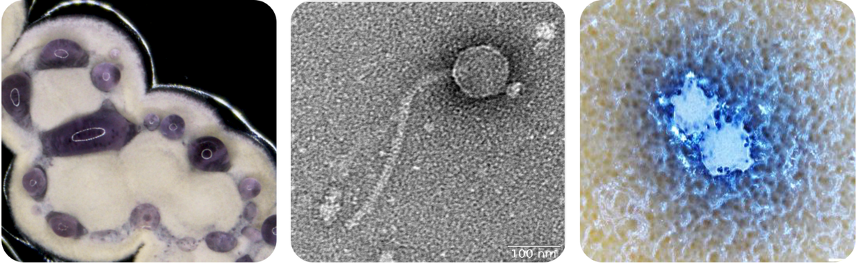 Graphic Streptomyces phages