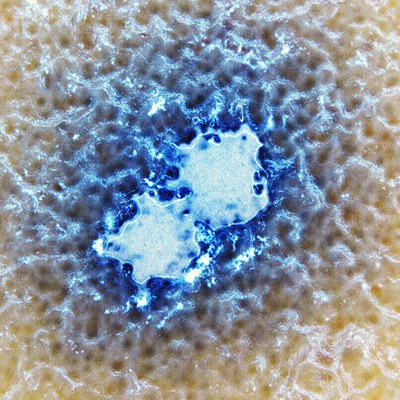 Image of bacterial immune systems