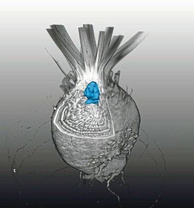 Sugar beet in MRI (Bild der Wissenschaft)