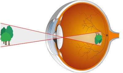 3D%20augen-aufbau%20final%204%20mit%20Baum%20gekr%C3%BCmmt%20neue%20Vorlage%28RGB%29.poster.jpeg