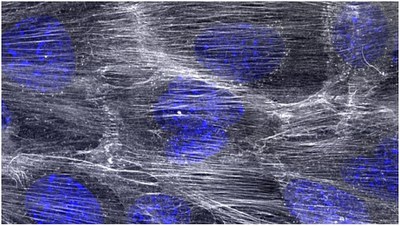 Keratinocytes with frame.jpg