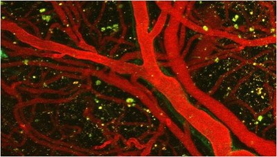 Mouse endothel with frame.jpg