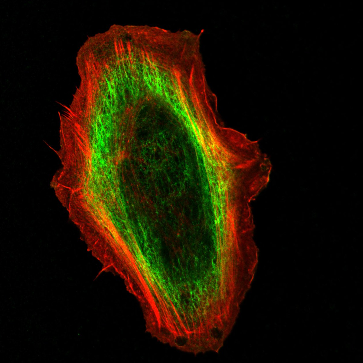 Keratins Contribute to Cell Stiffness