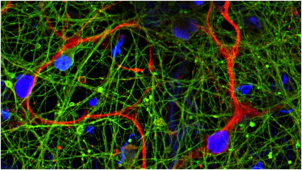 Understanding functional neuronal networks under strain