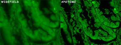 ApoTome Fluorescence Microscope