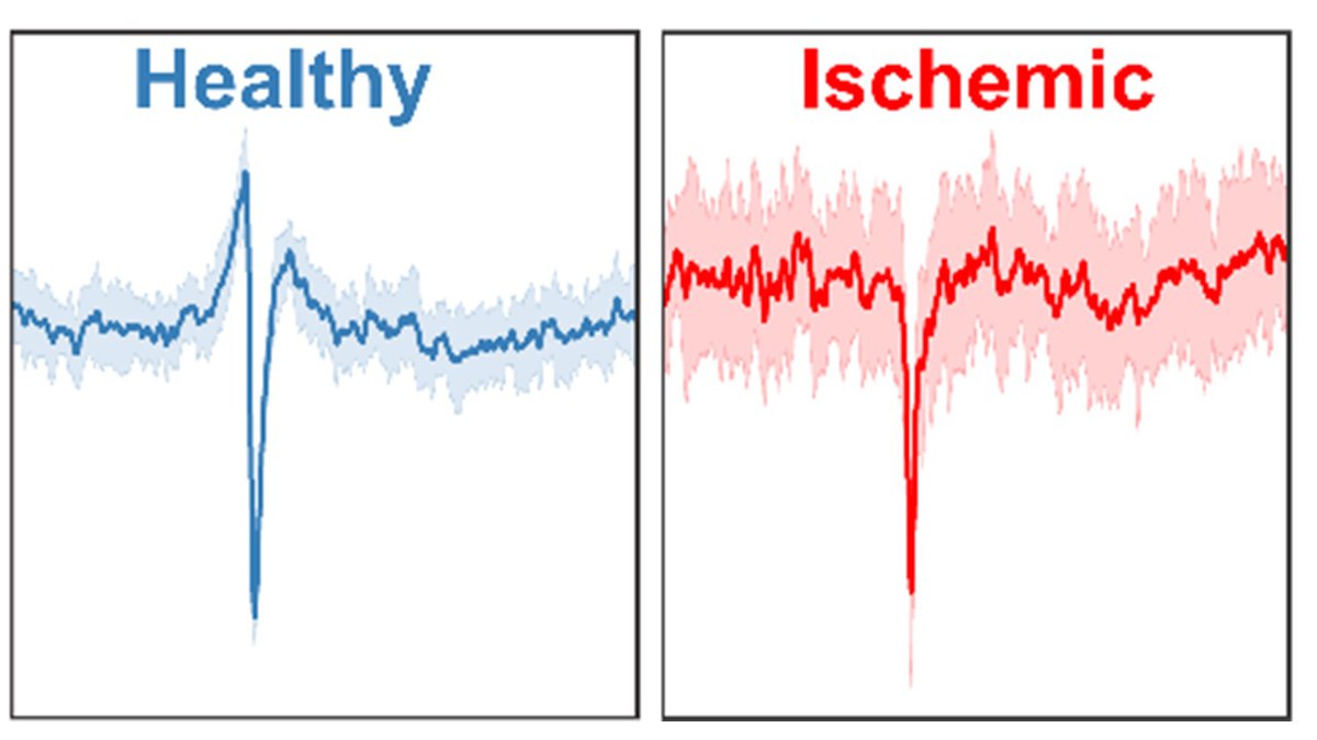 Nanowire/Graphene FETs