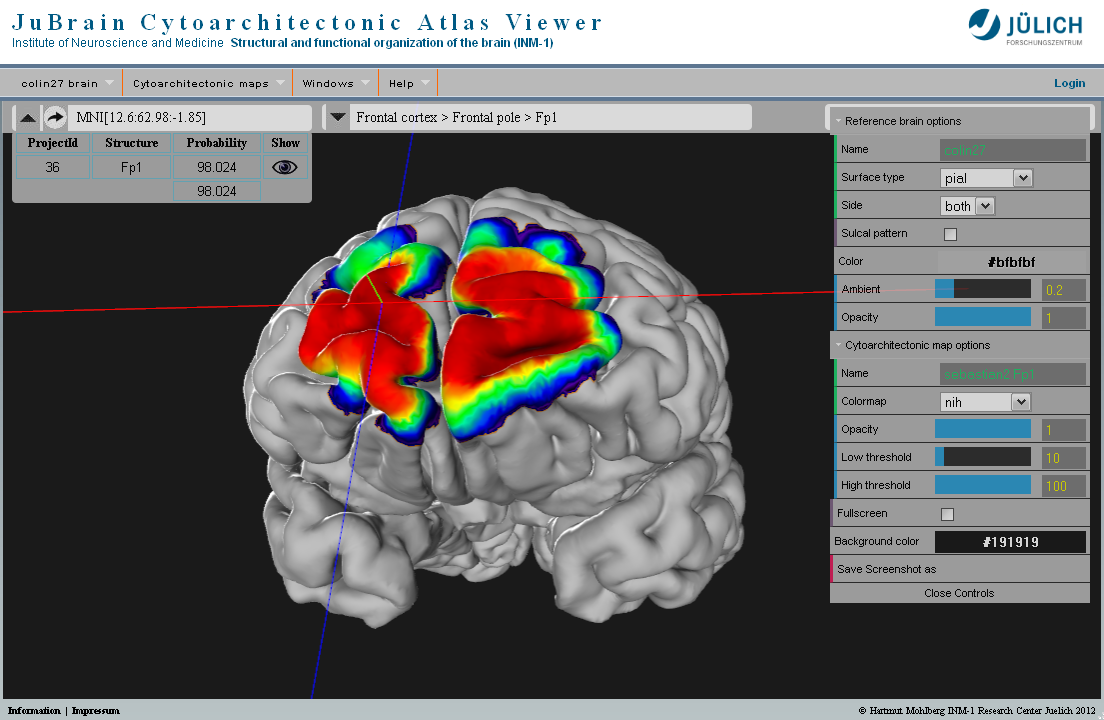 Julich-Brain Cytoarchitectonic Atlas
