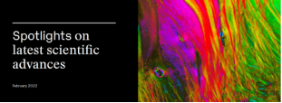 A combination of micro and macro methods sheds new light on how different brain regions are connected