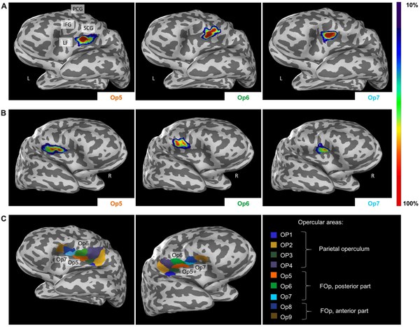 HBP researchers identify three new human brain areas involved in sexual sensation, motor coordination, and music processing