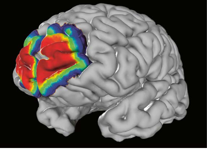 Regioncolored image of a brain