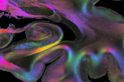 A combination of micro and macro methods sheds new light on how different brain regions are connected