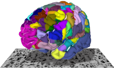 A colorful 3D model of a brain with different regions highlighted in various colors, placed on a textured surface.Visualisation of the 3D Julich Brain
