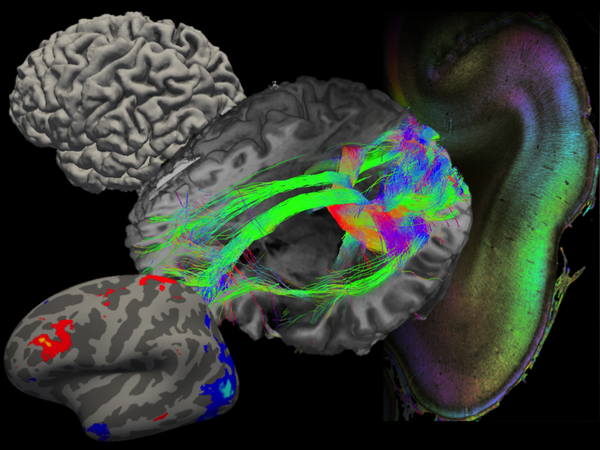 Cortical fibers
