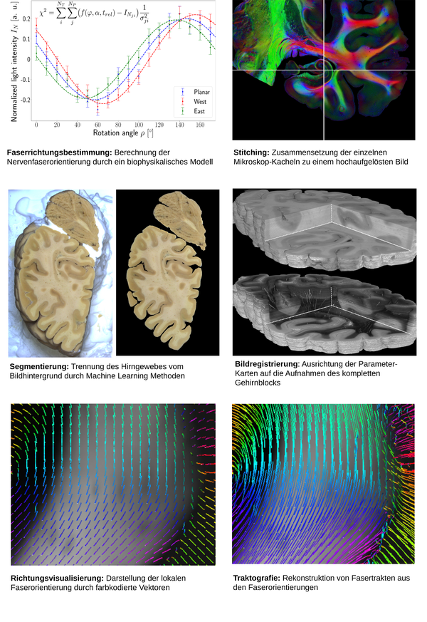Signal and Image Processing