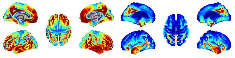 Imaging of Molecular Neuropathology