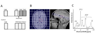 Diurnal metabolic changes in human brain