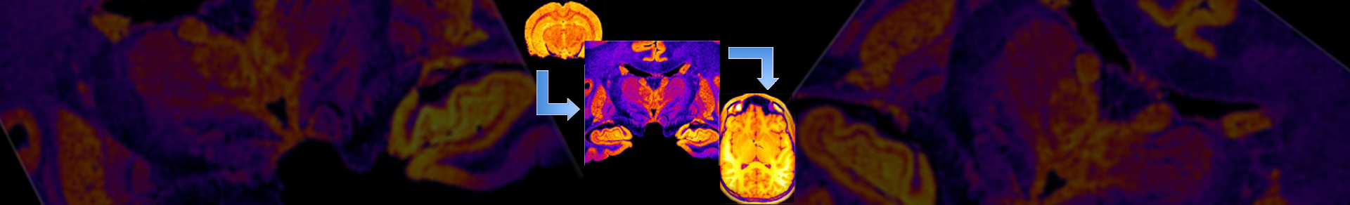 CONTRAST MECHANISMS