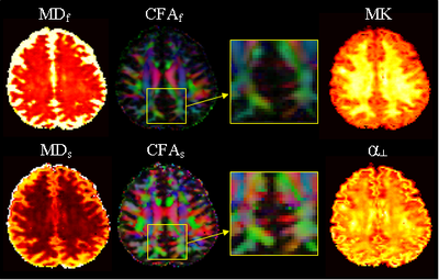 DIFFUSION IMAGING