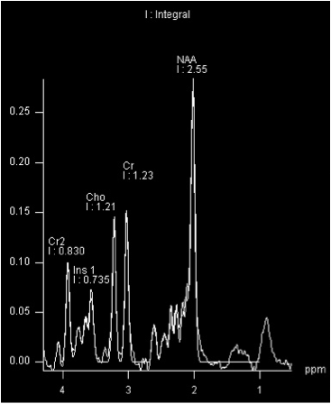 MRI Spectroscopy