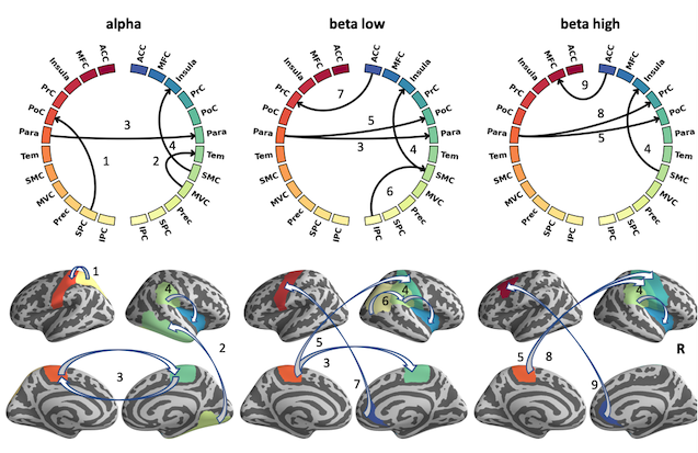 New insights into conflict processing networks using MEG