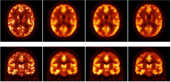 Development and optimisation of MR-PET applications