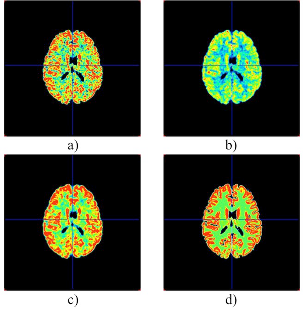 Development and optimisation of MR-PET applications