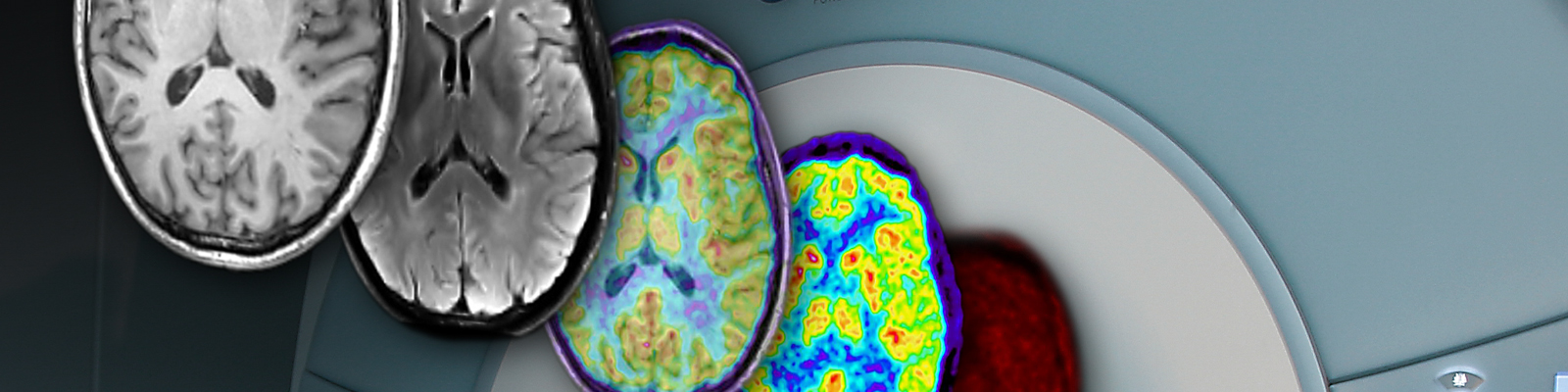 Medical Imaging Physics (INM-4)