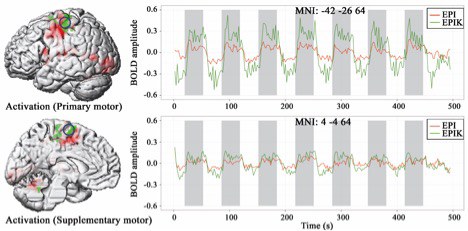 EPIK fMRI BOLD