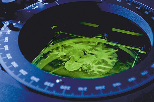Science: How Brain Research Makes New Demands on Supercomputing