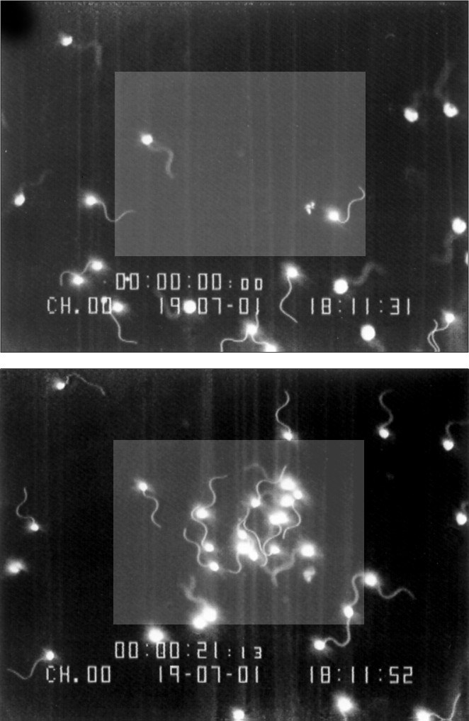 2003-13-Ansammlung_von_Spermien-klein_jpg