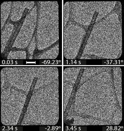 The image series serves as a data basis for the reconstruction of the 3D electron tomogram.