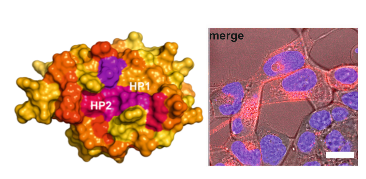 HIV-1 NEF illustration and fluorescence microscopic image / HIV-1 NEF Abbildung und fluoreszenzmikroskopische Aufnahme