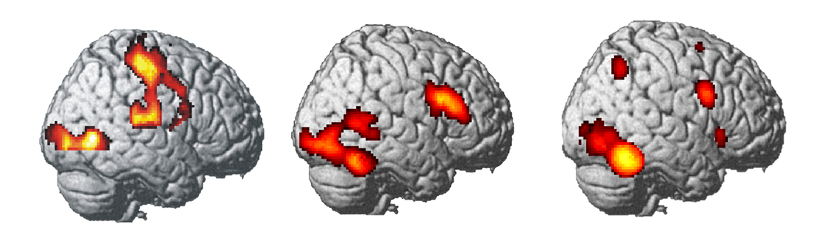 fMRI