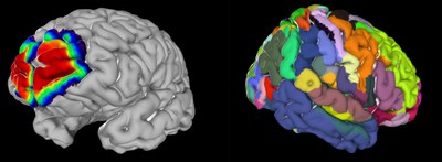 2020-07-30-julich-brain-karte.poster.jpeg