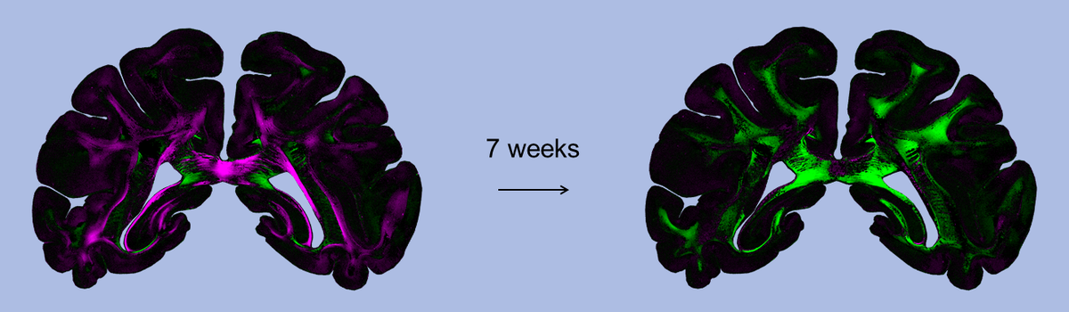 „Diattenuation Imaging“ (DI)