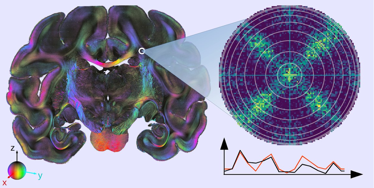 3D-PLI Messung eines Gehirnschnittes